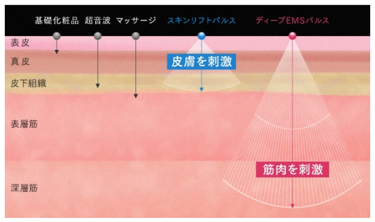 デンキバリブラシを超えた！？マイトレックス美顔器がヤバい5つの理由